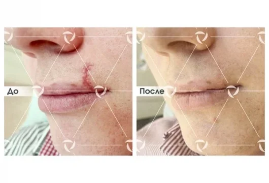 косметология линлайн на ленинградском шоссе фото 5 - tattooo.ru
