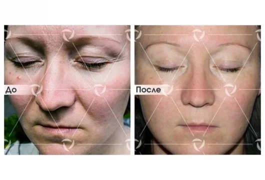 клиника лазерной косметологии линлайн на улице перерва фото 8 - tattooo.ru