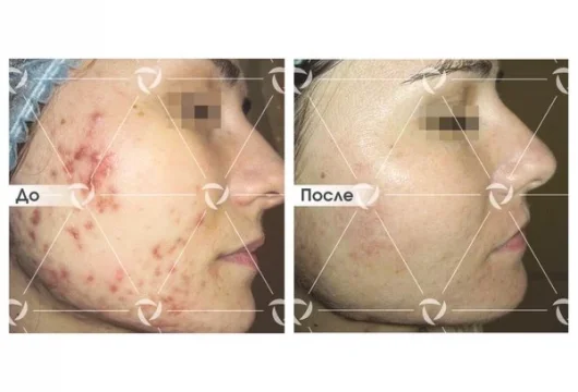 клиника лазерной косметологии линлайн в трубниковском переулке фото 1 - tattooo.ru