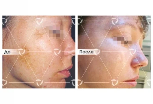 клиника лазерной косметологии линлайн в трубниковском переулке фото 5 - tattooo.ru