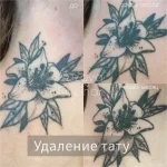 студия эпиляции и удаления тату elos фото 2 - tattooo.ru