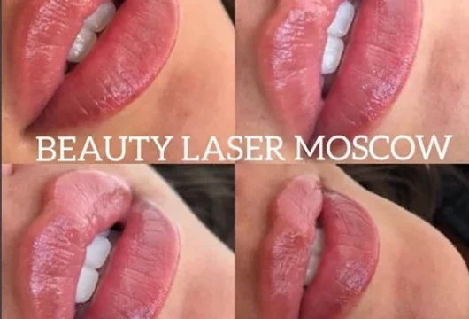 центр косметологии и дерматологии beauty laser фото 3 - tattooo.ru